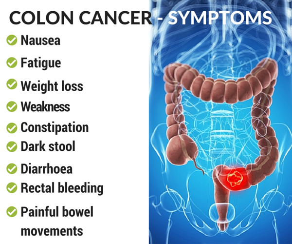 Colon Cancer - Causes, Diagnosis and Treatment