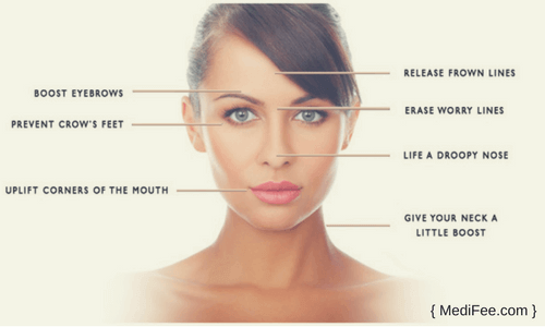 cosmetic treatment with botox