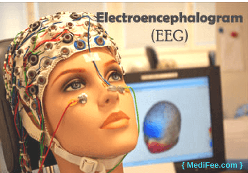 Brain Mapping Electroencephalography (EEG).png