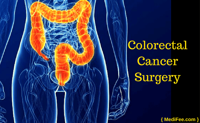 colorectal cancer surgery