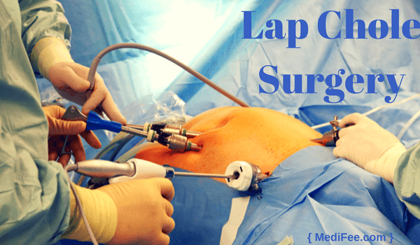 lap chole surgery lap chole surgery