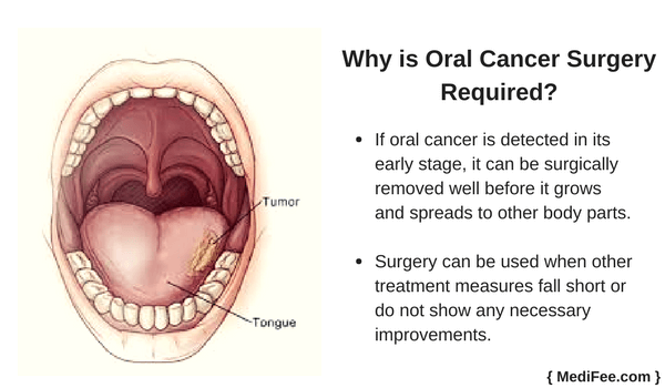 why is oral cancer required
