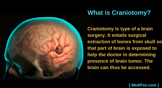 what is craniotomy