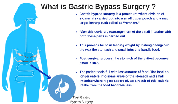 what is gastric bypass surgery